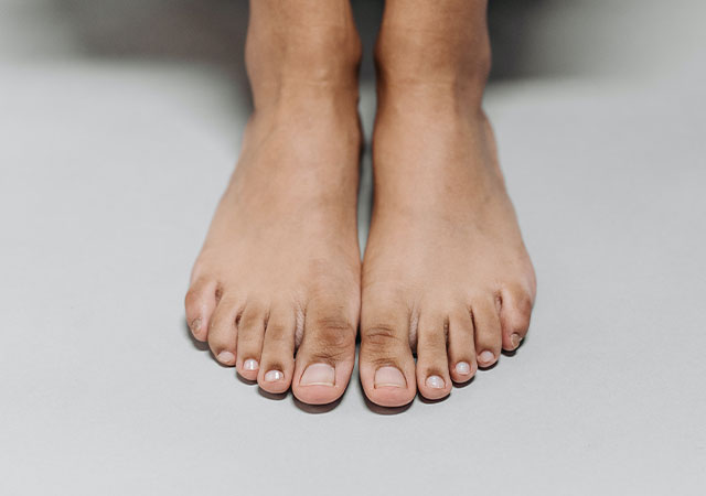 Hallux valgus & Hallux rigidus Mit orthopädischen Einlagen können Fehlbelastungen minimiert werden.